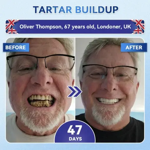 Tideglusib Fast‑Dissolving Tooth & Gum Repair Oral Strips - Image 3