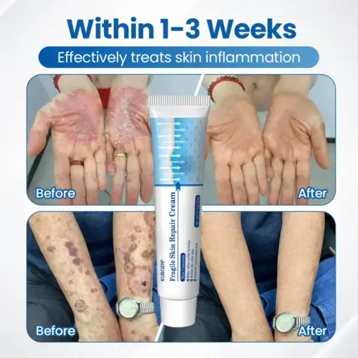 Fragile Skin Repair Cream - Image 2
