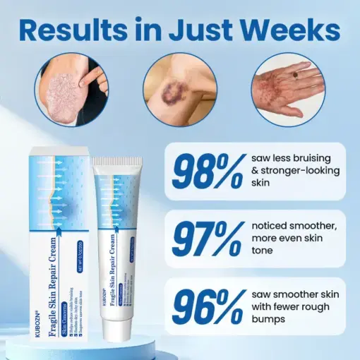Fragile Skin Repair Cream - Image 4