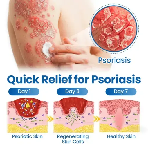Fragile Skin Repair Cream - Image 8
