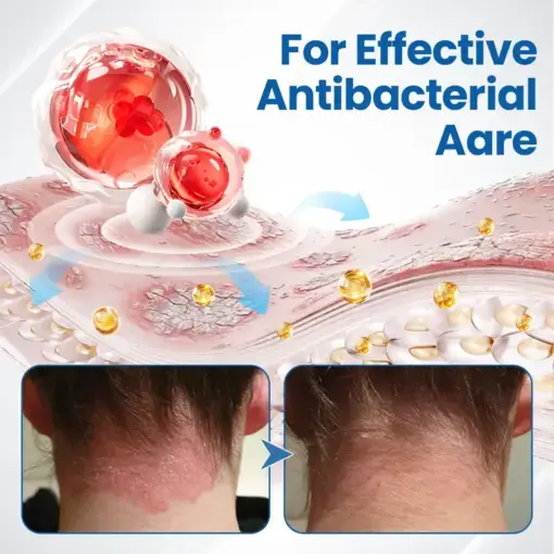 Fragile Skin Repair Cream - Image 9