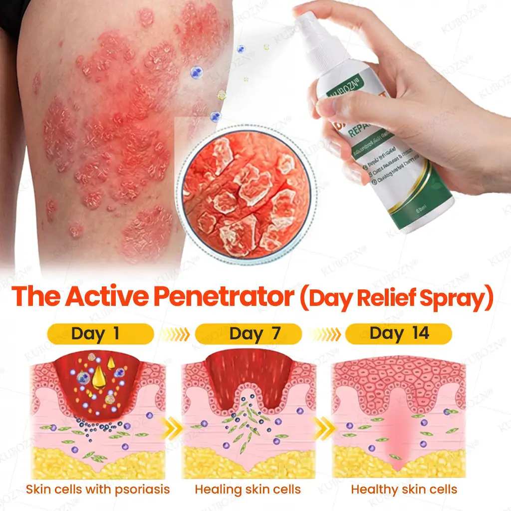 Psoriasis Day & Night Repair System - Image 2