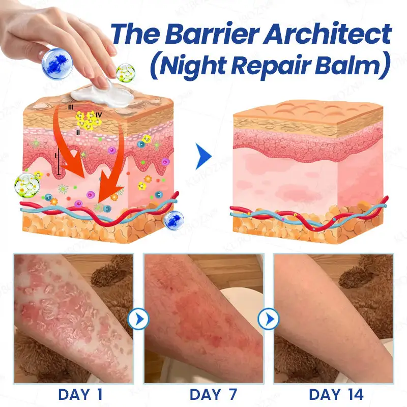 Psoriasis Day & Night Repair System - Image 3