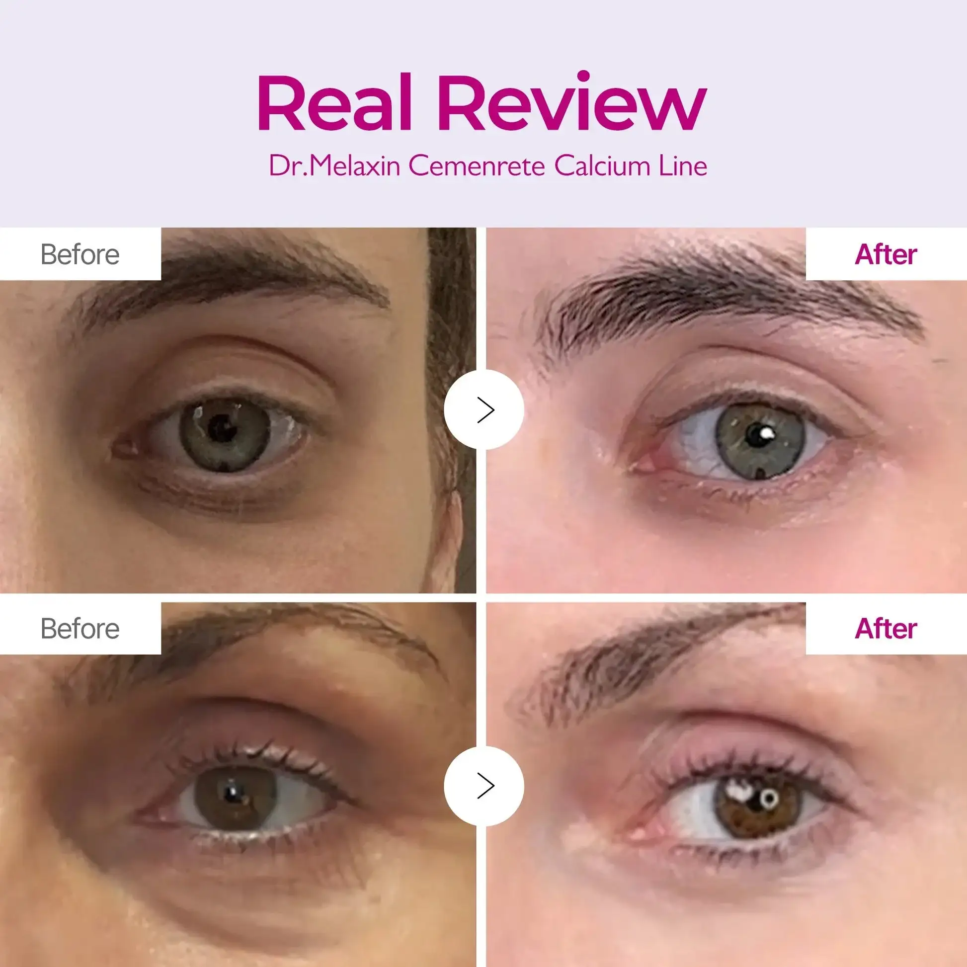 Calcium Dark Spot Eye Cream - Image 13