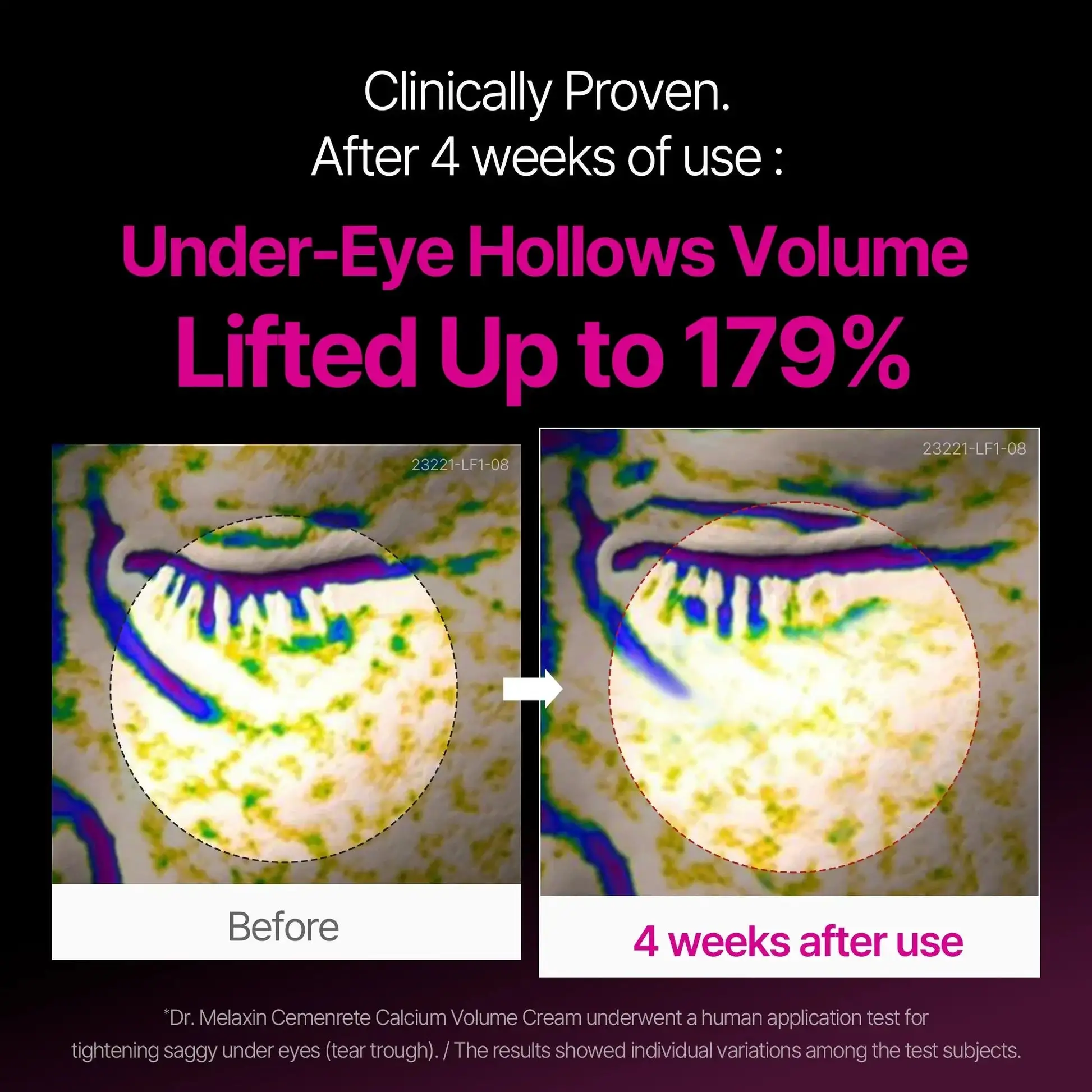 Calcium Dark Spot Eye Cream - Image 9
