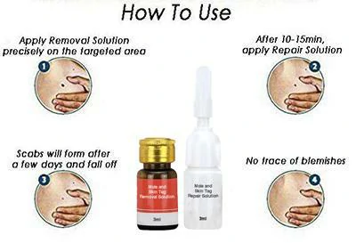 Mole & Skin Tag Removal Solution - Image 4
