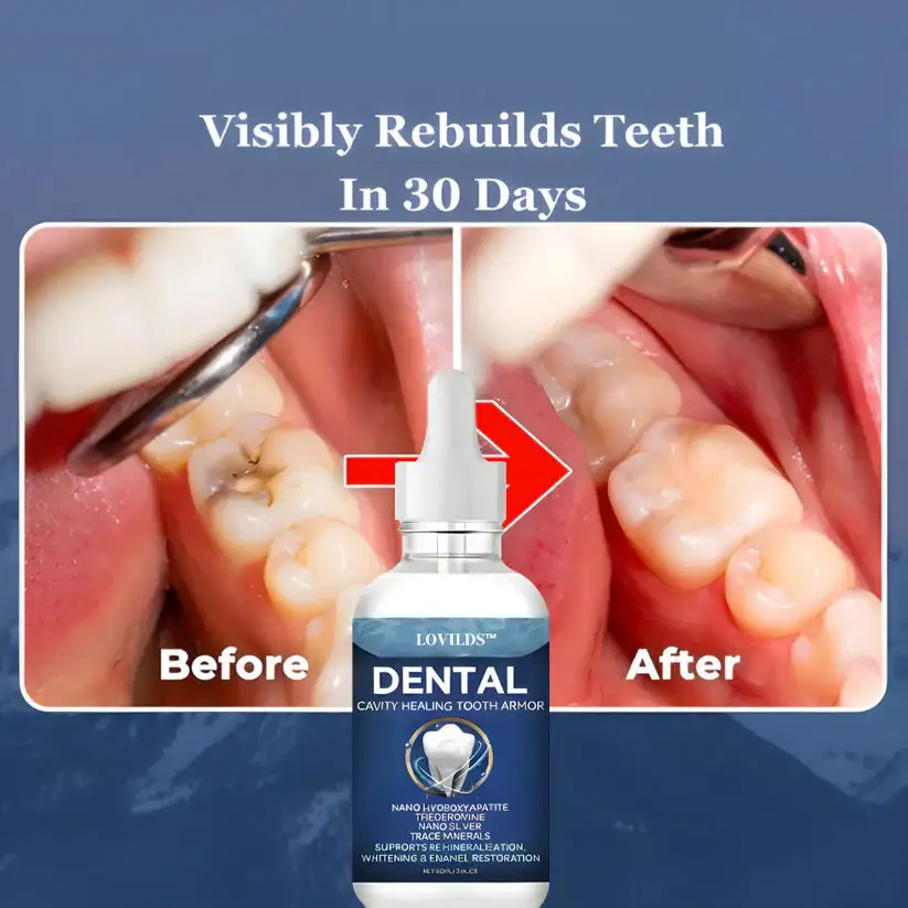 Advanced Enamel Repair & Whitening Kit - Image 5