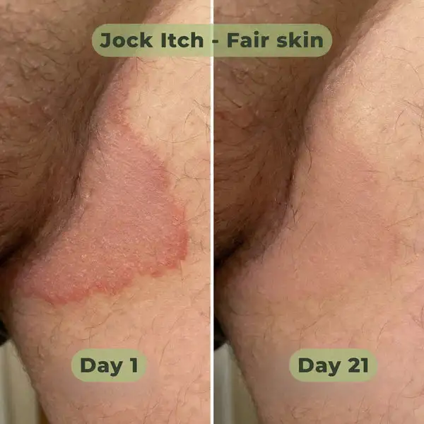 Antifungal Purifying Soap - Image 2