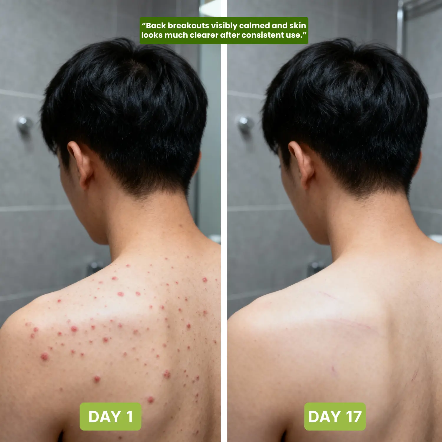 Antifungal Purifying Soap - Image 4