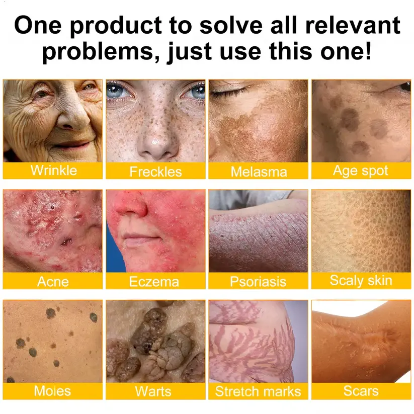 Bee Poison Skin Restoration Cream - Image 4