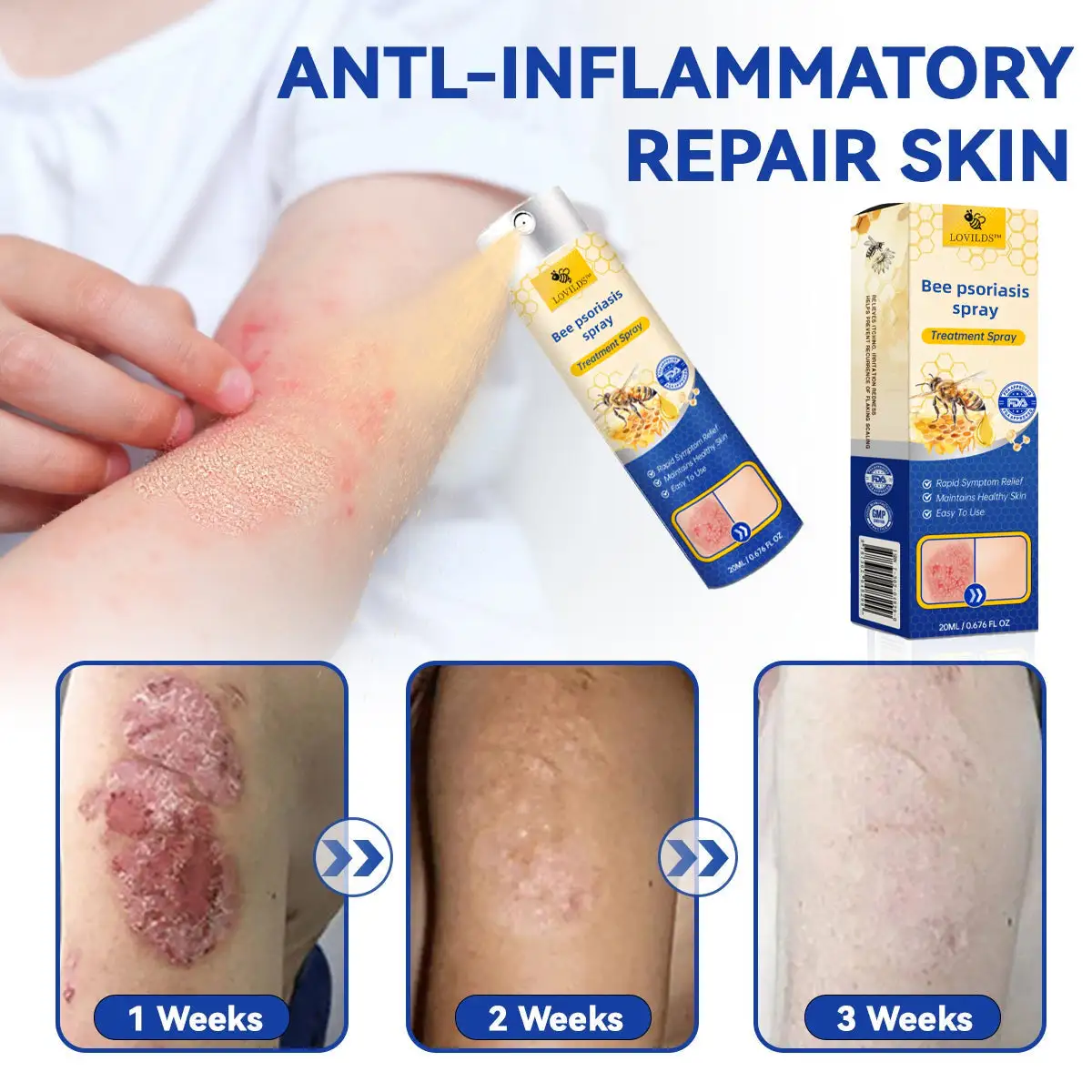 PsoriaHeal Bee Psoriasis Treatment Spray pro - Image 3