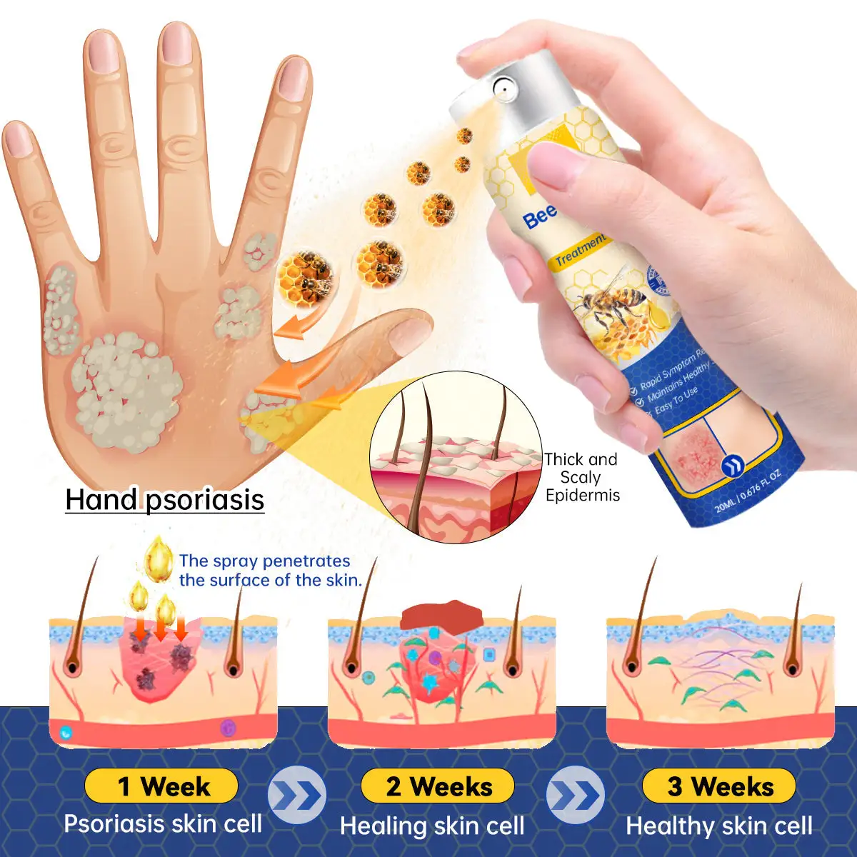 PsoriaHeal Bee Psoriasis Treatment Spray pro - Image 7