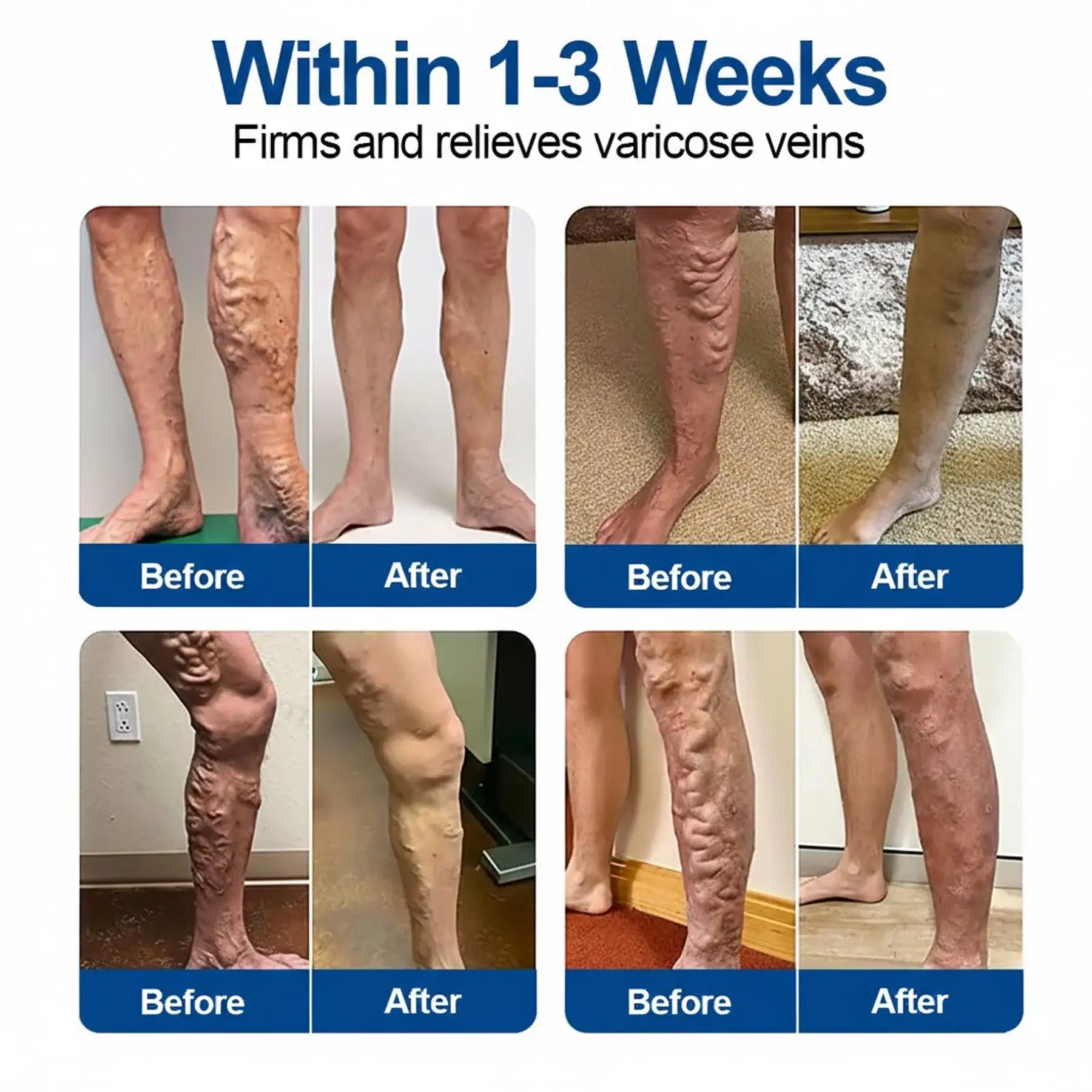 VeinEase Microneedle Care Patch - Image 3