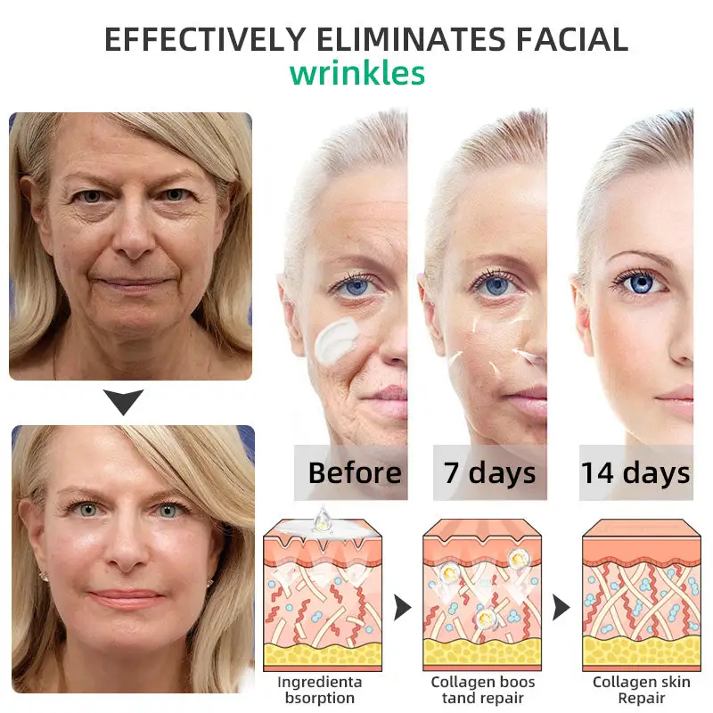 Wrinkle Removel Cream,Address Crepe & Sagging - Image 9