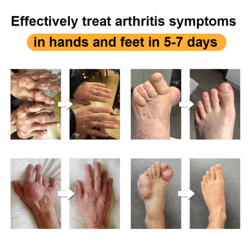 Joint & Bone Therapy Turmeric Ginger Treatment Spray - Image 4