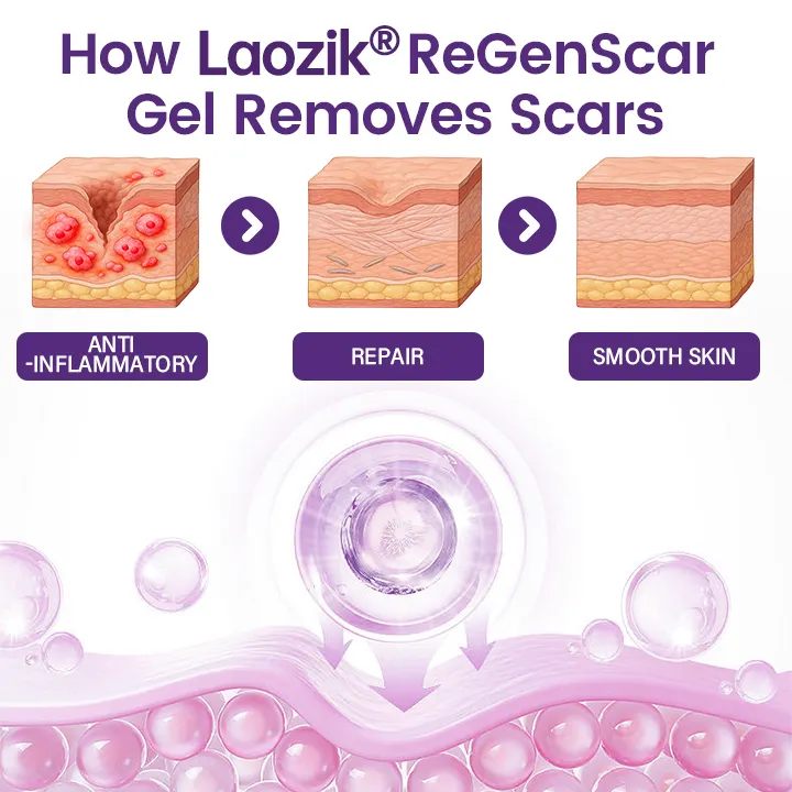 ReGenScar Stem Cell Repair Gel - Image 4
