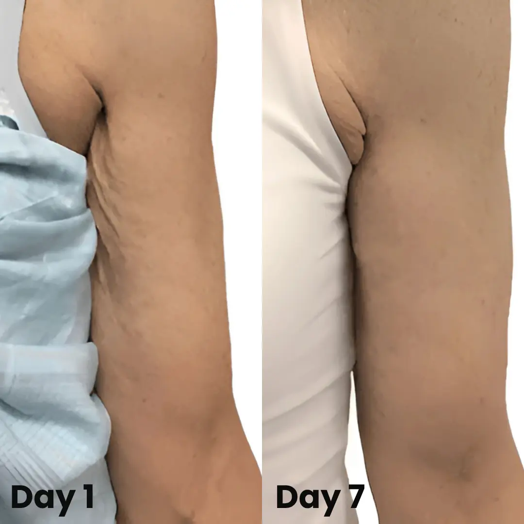Collagen Oil – Firms Sagging Skin & Reduces Wrinkles Fast - Image 8