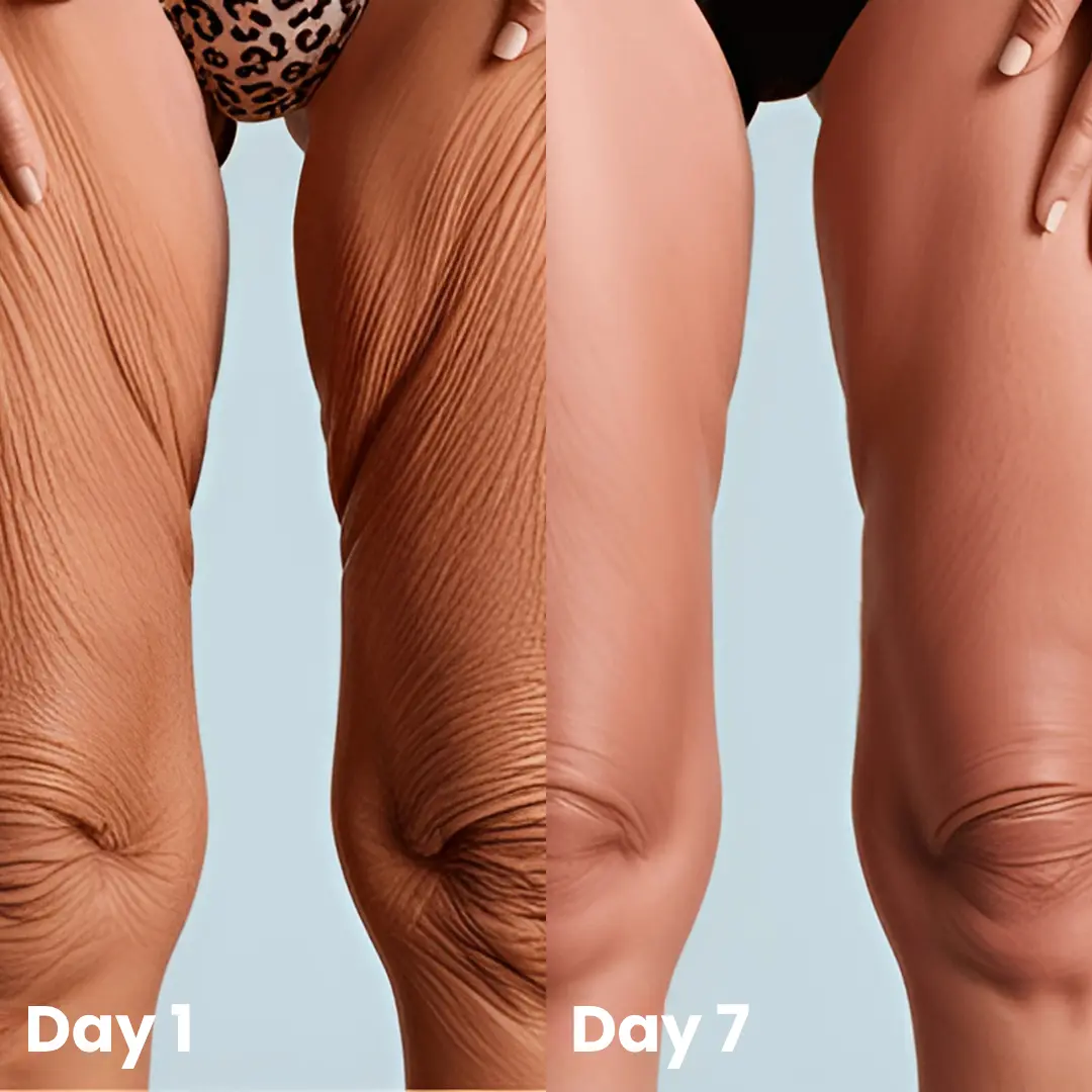 Collagen Oil – Firms Sagging Skin & Reduces Wrinkles Fast - Image 9