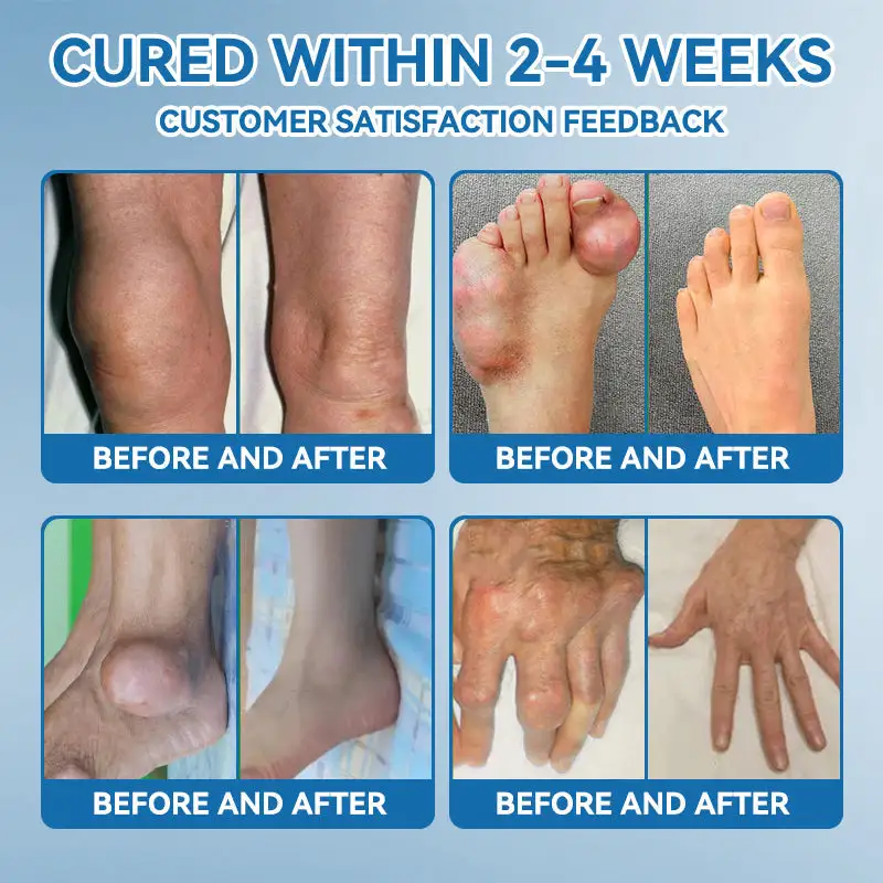 BPC-157 Joint Healing Cream - Image 5