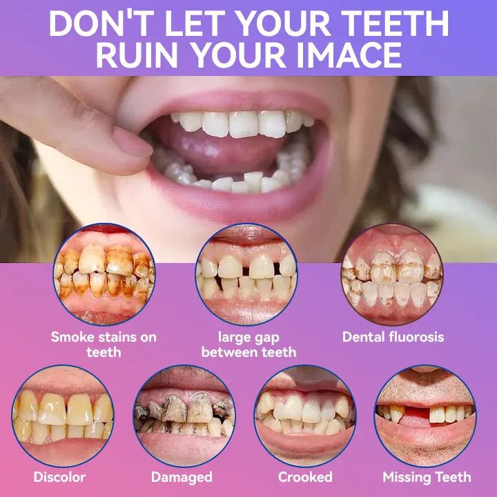 Latest Premium Comfort Dentures - Image 16