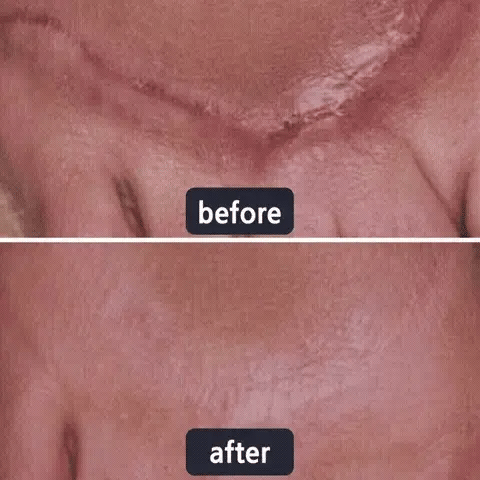 Scar Repair Cream - Image 10
