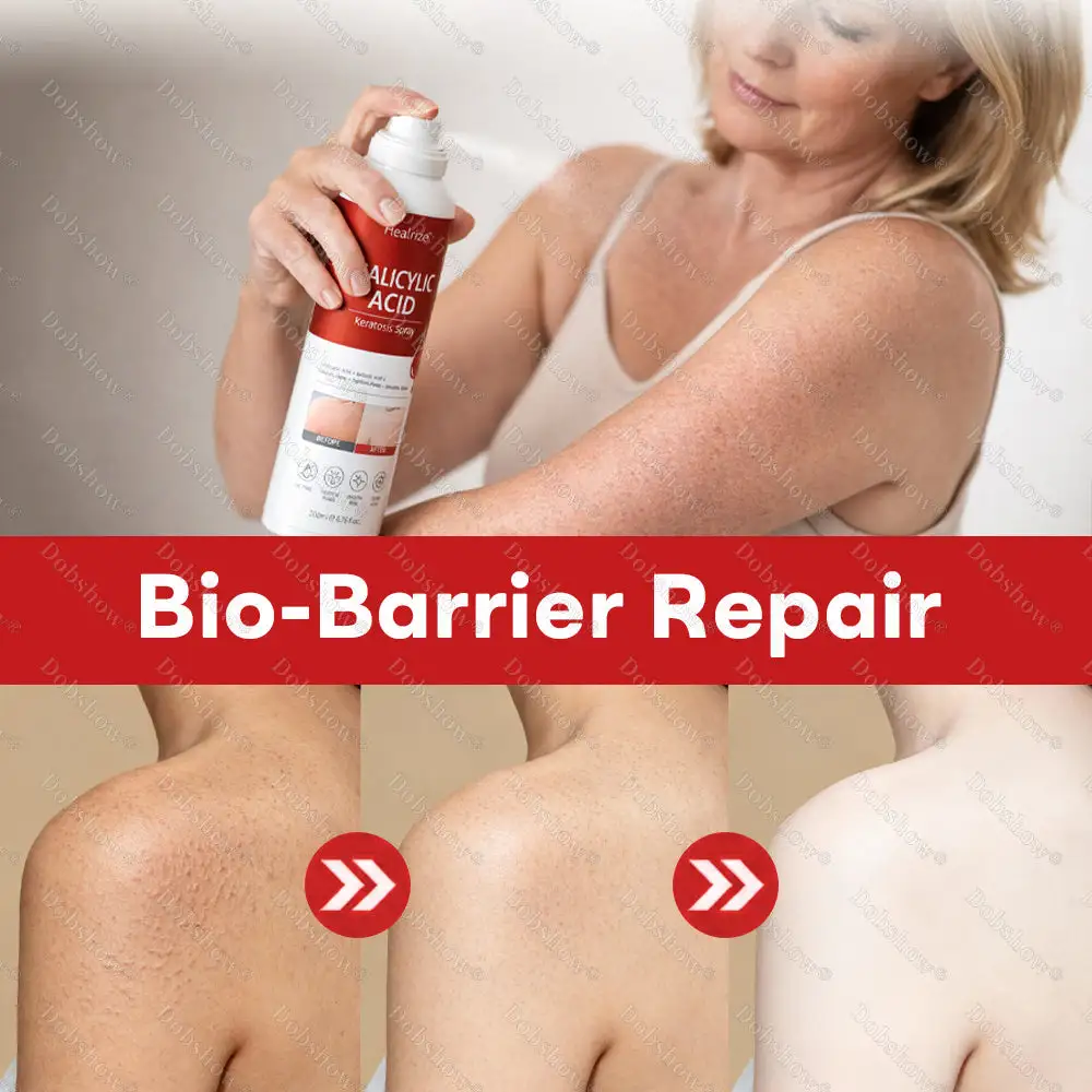 Salicylic Acid Keratosis Spray - Image 4