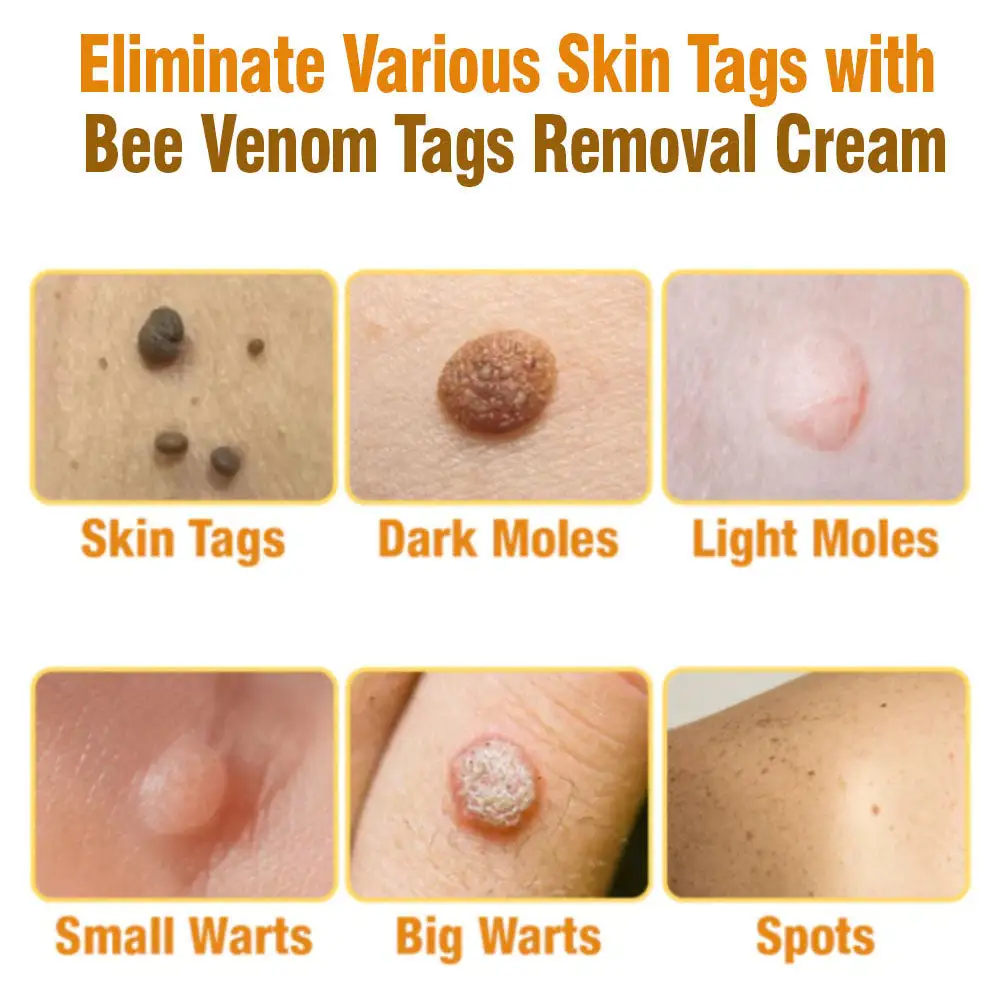 Australian Bee Venom Tags Removal Cream - Image 2