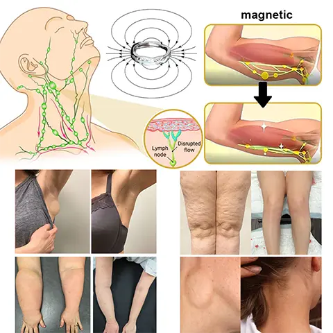 Lymphatic Magnetic Luminous Ring - Image 9