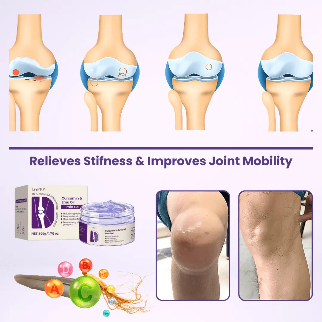 Curcumin & Emu Oil Pain Gel - Image 2