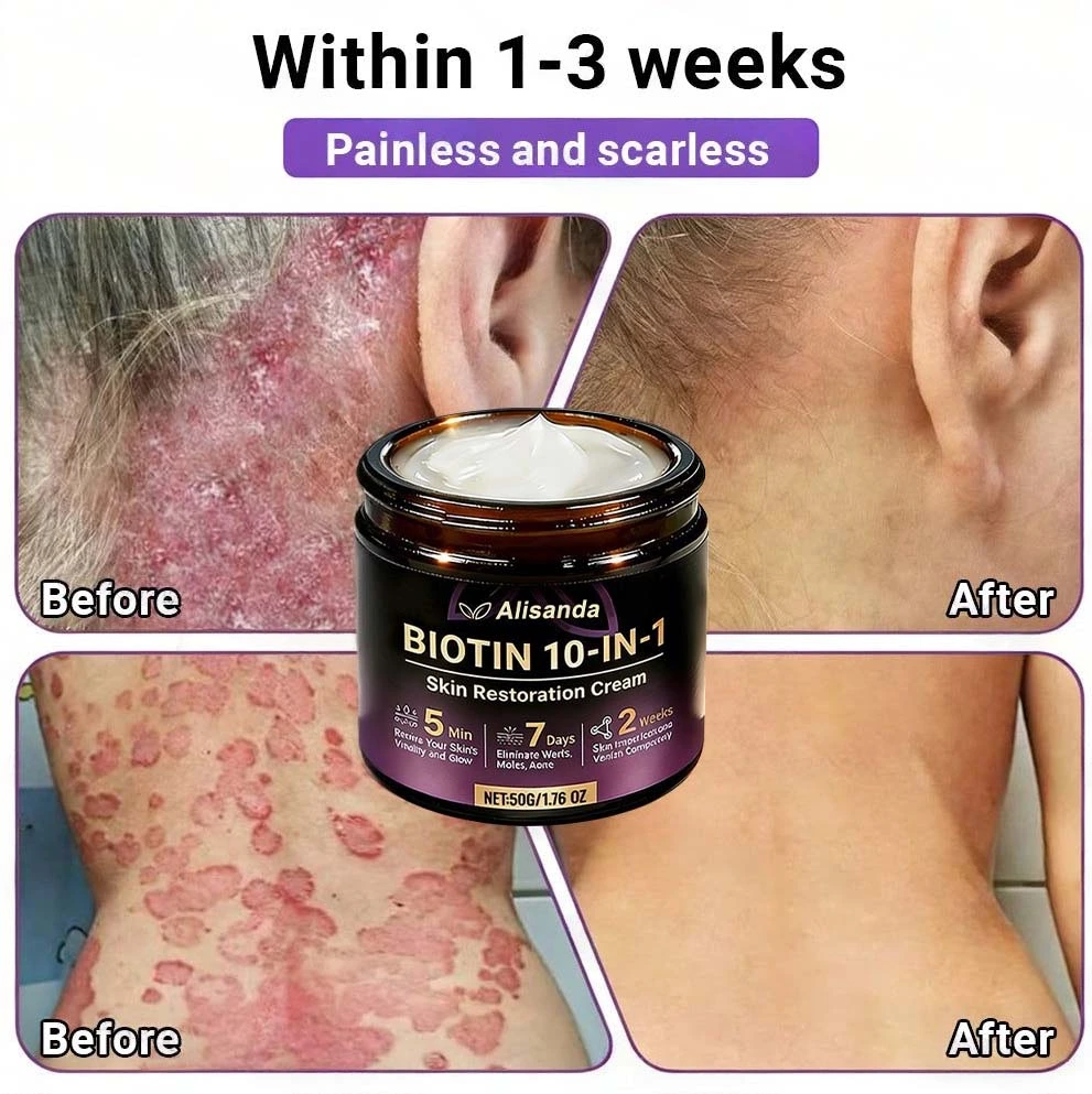 Biotin 10-in-1 Skin Restoration Cream - Image 11