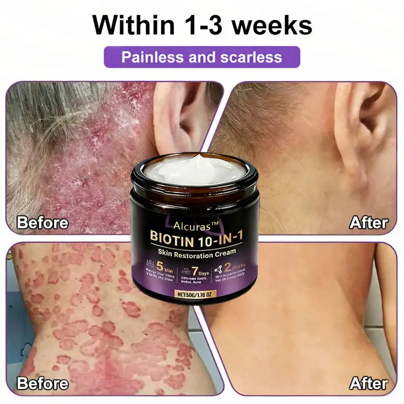 Biotin 10-in-1 Skin Restoration Cream - Image 8
