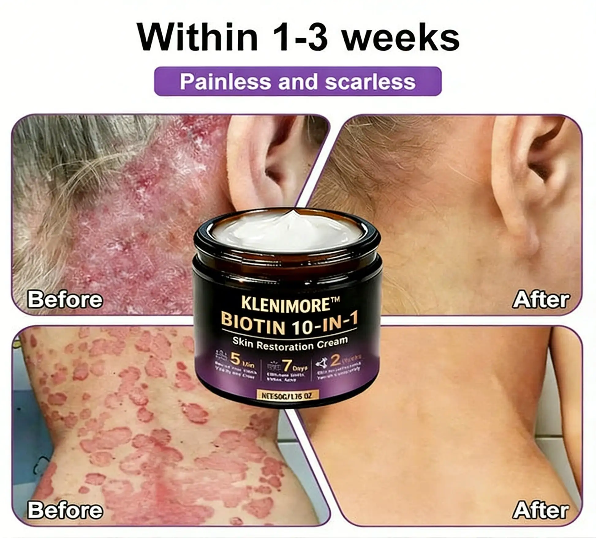 Biotin 10-in-1 Skin Restoration Cream - Image 6