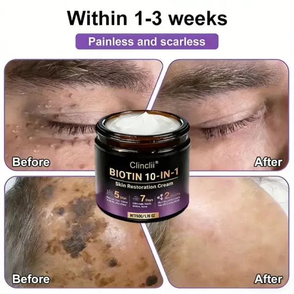 Biotin 10-in-1 Skin Restoration Cream – Last Day Promotion: 75% OFF - Image 7