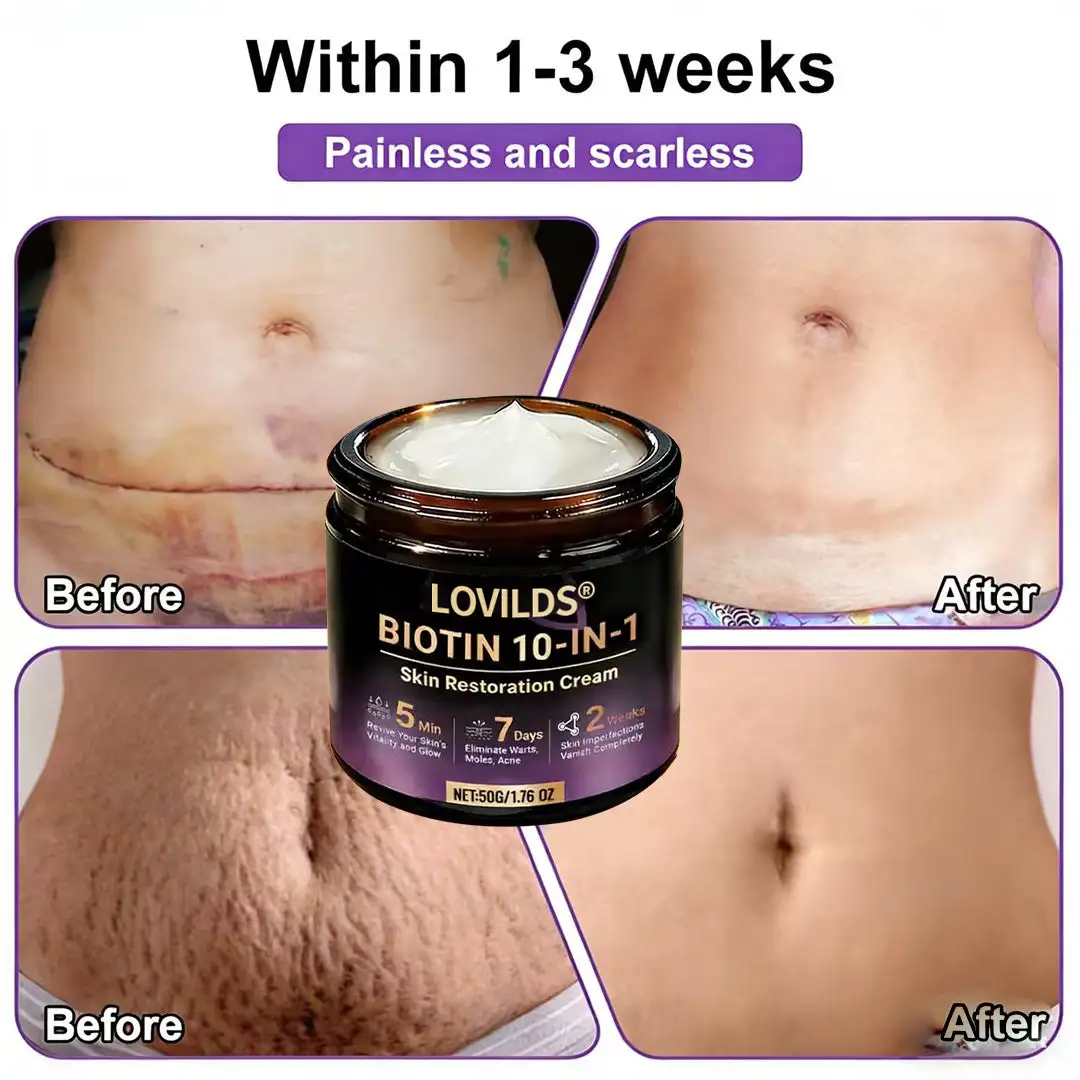 Biotin 10-in-1 Skin Restoration Cream - Image 7