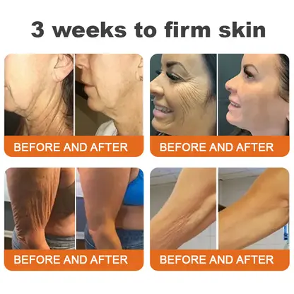 Tightening Burn Gold Massage Cream - Image 7