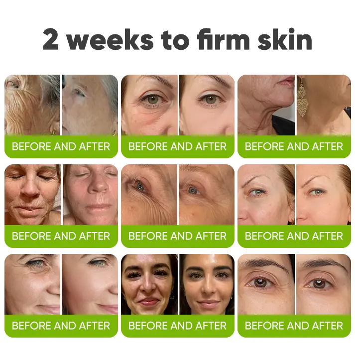 Skin Tightening & Vita-A Retinol Retinol shot Anti-Wrinkle Firming Tightening cream - Image 8
