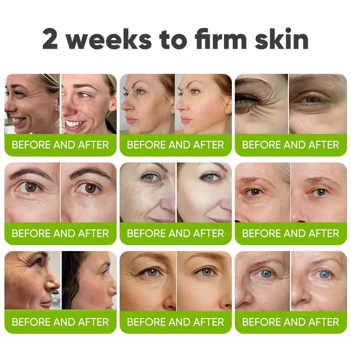 Skin Tightening & Vita-A Retinol Retinol shot Anti-Wrinkle Firming Tightening cream - Image 7