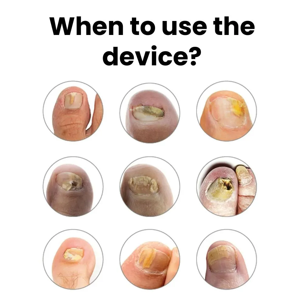 ClearNail Blue Light Device - Image 6