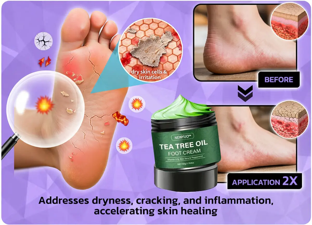 Tea Tree Oil Foot Cream - Image 12