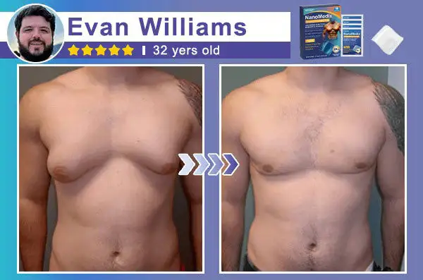 Gynecomastia Chest Fatburn & Firm Patch - Image 3