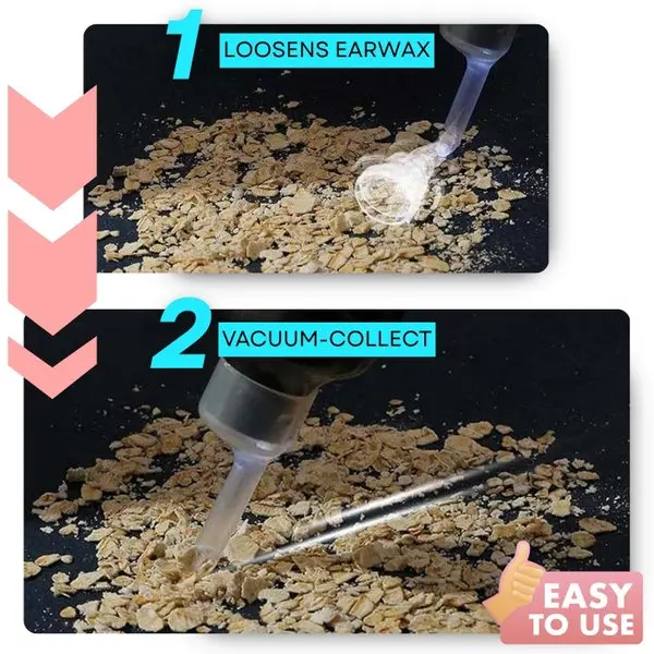 Electric Ear Wax Vacuum Cleaner - Image 4