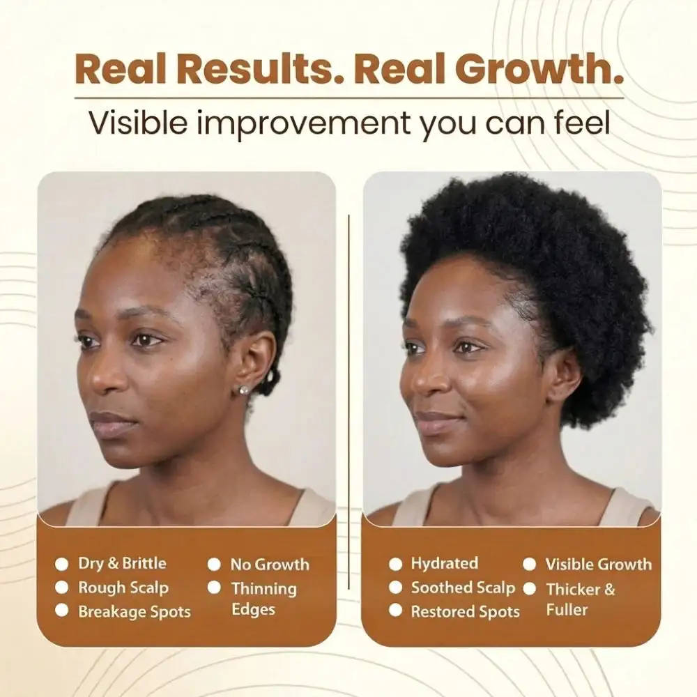 Batana Oil Shampoo 300ml+Batana Oil Conditioner 300ml(1 Set) - Image 6