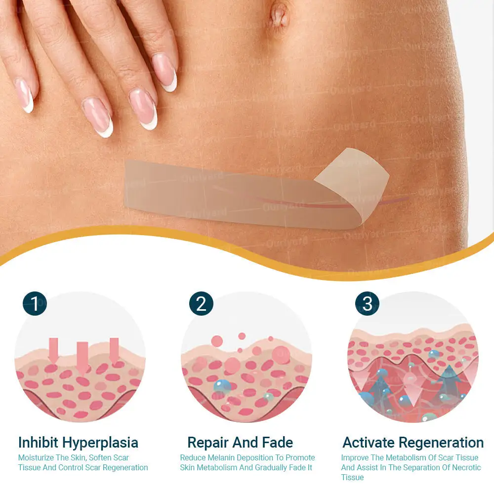 Hyaluronic Acid Microneedle Repair Tape - Image 4