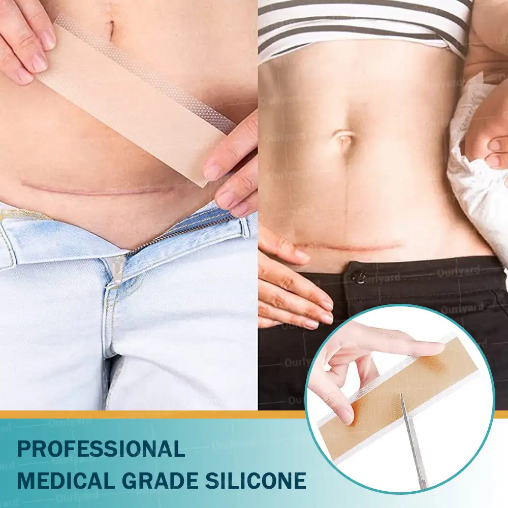 Hyaluronic Acid Microneedle Repair Tape - Image 6