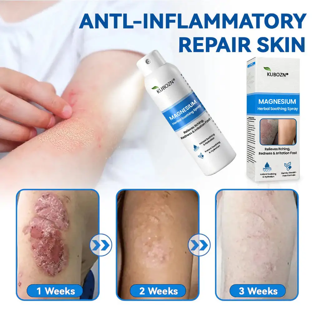 Magnesium Herbal Psoriasis Spray - Image 7