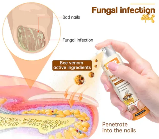 Bee Venom Nail Fungus Spray - Image 2