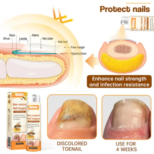 Bee Venom Nail Fungus Spray - Image 4
