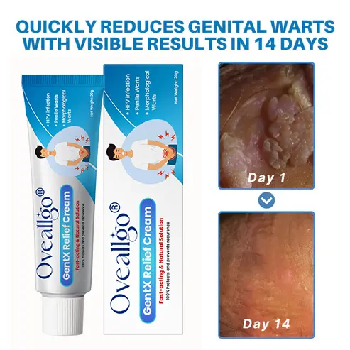 HPV Genital Warts Relief Cream - Image 2