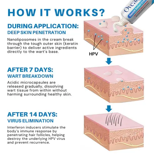 HPV Genital Warts Relief Cream - Image 4