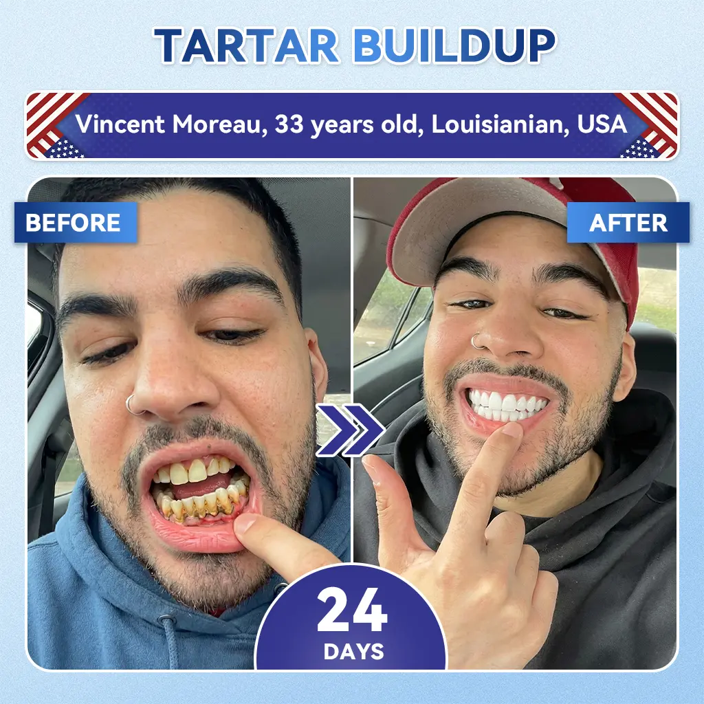 Tideglusib Fast‑Dissolving Tooth & Gum Repair Oral Strips - Image 8